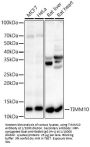 Mitochondrial Import Inner Membrane Translocase Subunit Tim10 (TIMM10) Antibody