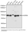 Nucleolar Protein 58 (NOP58) Antibody