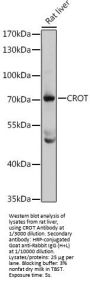 Carnitine O-Octanoyltransferase (CROT) Antibody