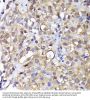 Submergence Induced Protein 2 (ADI1) Antibody