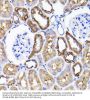 Submergence Induced Protein 2 (ADI1) Antibody