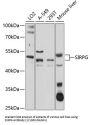 Signal Regulatory Protein Gamma (SIRPG) Antibody