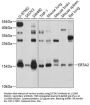 Eukaryotic Translation Initiation Factor 5A-2 (EIF5A2) Antibody