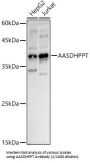 L-Aminoadipate-Semialdehyde Dehydrogenase-Phosphopantetheinyl Transferase (AASDHPPT) Antibody