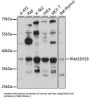 Ribonuclease H2 Subunit B (RNASEH2B) Antibody