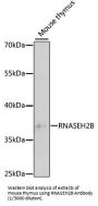 Ribonuclease H2 Subunit B (RNASEH2B) Antibody