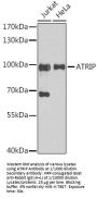 ATR-Interacting Protein (ATRIP) Antibody