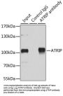 ATR-Interacting Protein (ATRIP) Antibody