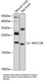Myosin Light Chain 12B (MYL12B) Antibody