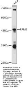 Ribonucleoside-Diphosphate Reductase Subunit M2 (RRM2) Antibody
