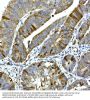 Ribonucleoside-Diphosphate Reductase Subunit M2 (RRM2) Antibody