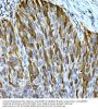 Ribonucleoside-Diphosphate Reductase Subunit M2 (RRM2) Antibody