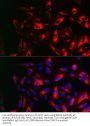 Ribonucleoside-Diphosphate Reductase Subunit M2 (RRM2) Antibody