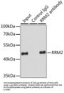 Ribonucleoside-Diphosphate Reductase Subunit M2 (RRM2) Antibody
