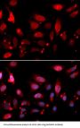 Rac-GTPase Activating Protein 1 (RACGAP1) Antibody