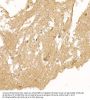 Calcipressin-1 (RCAN1) Antibody