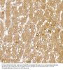 Calcipressin-1 (RCAN1) Antibody