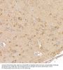 Calcipressin-1 (RCAN1) Antibody