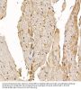 Calcipressin-1 (RCAN1) Antibody