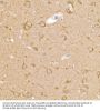 Calcipressin-1 (RCAN1) Antibody