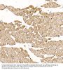 Calcipressin-1 (RCAN1) Antibody