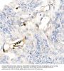 S100 Calcium Binding Protein A12 (S100A12) Antibody
