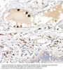 S100 Calcium Binding Protein A12 (S100A12) Antibody