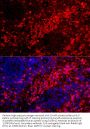 S100 Calcium Binding Protein A12 (S100A12) Antibody