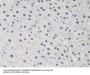 Checkpoint Protein HUS1 (HUS1) Antibody
