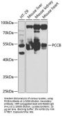 Propionyl-CoA Carboxylase Beta Chain, Mitochondrial (PCCB) Antibody