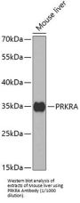 Interferon-Inducible Double-Stranded RNA-Dependent Protein Kinase Activator A (PRKRA) Antibody