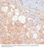 Receptor Interacting Serine Threonine Kinase 3 (RIPK3) Antibody