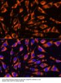 Receptor Interacting Serine Threonine Kinase 3 (RIPK3) Antibody