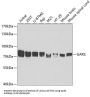Glycyl-tRNA Synthetase (GARS1) Antibody