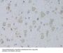 Glycyl-tRNA Synthetase (GARS1) Antibody