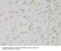 Glycyl-tRNA Synthetase (GARS1) Antibody