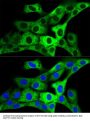 Glycyl-tRNA Synthetase (GARS1) Antibody
