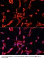 Glycyl-tRNA Synthetase (GARS1) Antibody