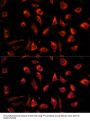 Translationally-Controlled Tumor Protein (TPT1) Antibody