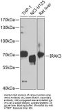 Interleukin-1 Receptor Associated Kinase 3 (IRAK3) Antibody