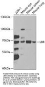 Lamin-B Receptor (LBR) Antibody