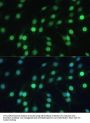 Lamin-B Receptor (LBR) Antibody