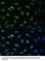 Lamin-B Receptor (LBR) Antibody