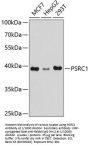 Proline/Serine Rich Coiled Coil Protein 1 (PSRC1) Antibody