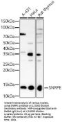 Small Nuclear Ribonucleoprotein E (SNRPE) Antibody