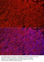 Aldehyde Dehydrogenase 3 Family Member A1 (ALDH3A1) Antibody
