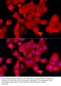Aldehyde Dehydrogenase 3 Family Member A1 (ALDH3A1) Antibody
