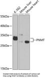 Phenylethanolamine N-Methyltransferase (PNMT) Antibody