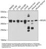 Ribosomal Protein Lateral Stalk Subunit P0 (RPLP0) Antibody