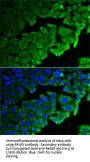 Ribosomal Protein Lateral Stalk Subunit P0 (RPLP0) Antibody